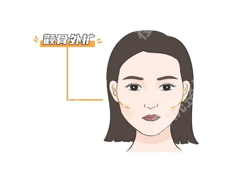 西京医院磨骨手术费用？大概4万元起、顾客点评及真实案例公开