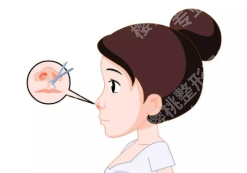 上海九院注射鼻子多少钱?7k 元起,项目优势、特点+人气医生展示