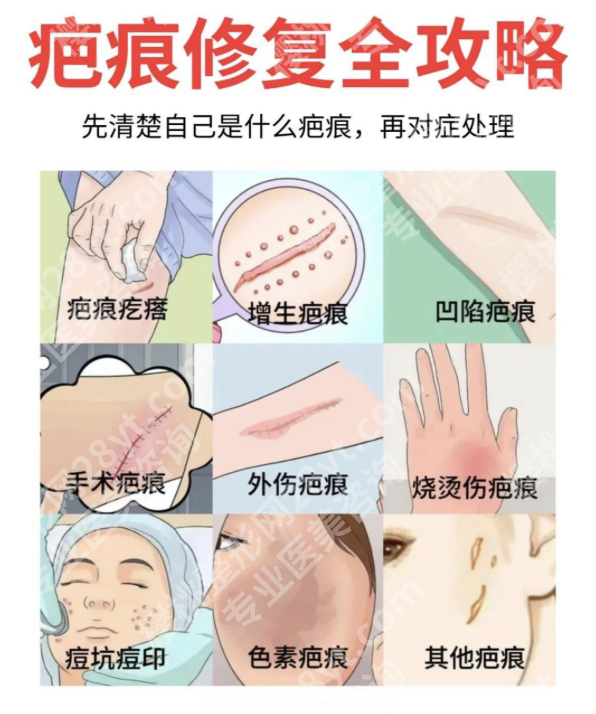 浙一医院祛疤怎么样？“硬实力”大起底，到底强在哪