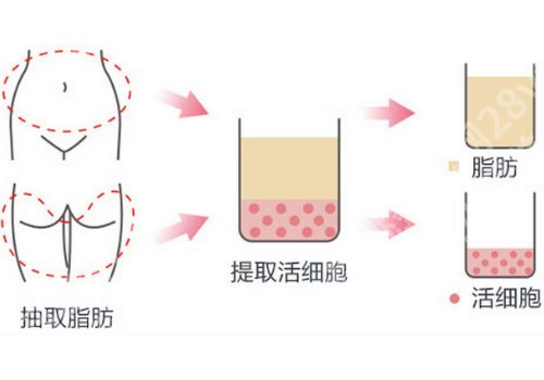 八大处脂肪填充额头得多少钱？6k元起，主打项目+常见问题展示！