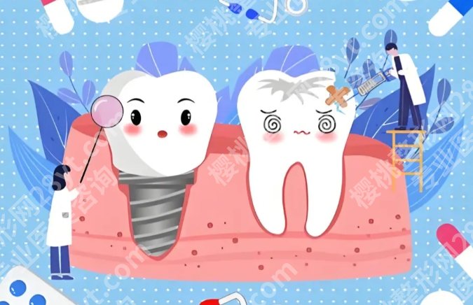 上海九院种植牙费用，价格优势明显，附不同品牌选择建议和省钱技巧