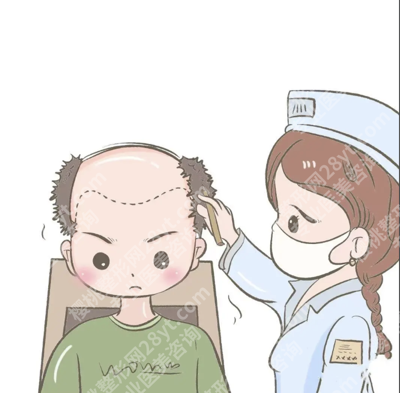 华西医院植发在哪个科室？居然能挂两个科，90%的人都选错了