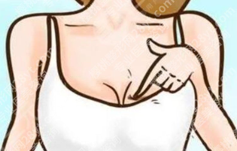上海九医院假体隆胸多少钱？手术费用构成，新手必看避坑解析