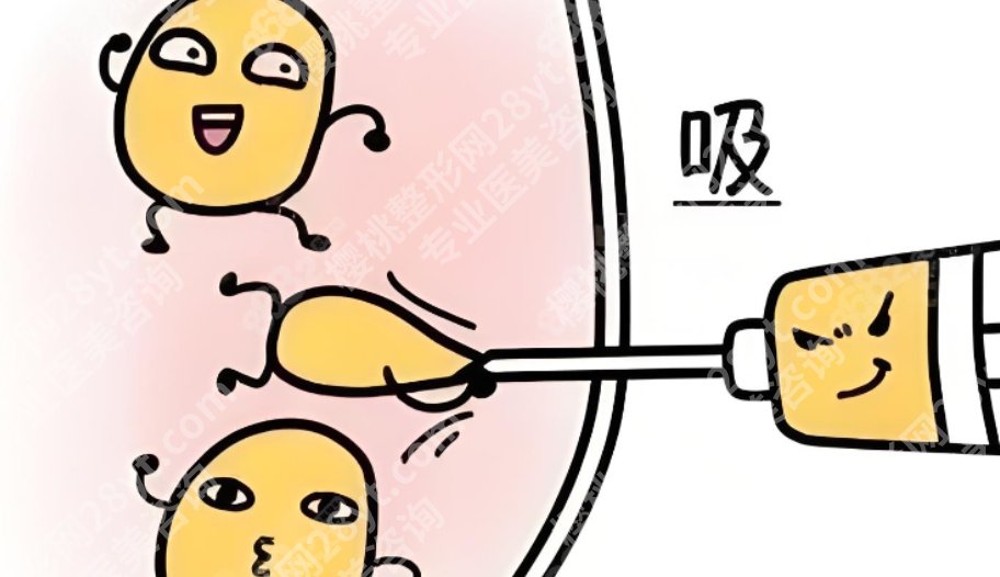 上海第九人民医院抽脂价格，一篇讲清价格构成和区间