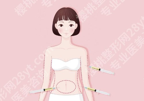 西安西京医院吸脂怎么样？多少钱？低至8000元起！