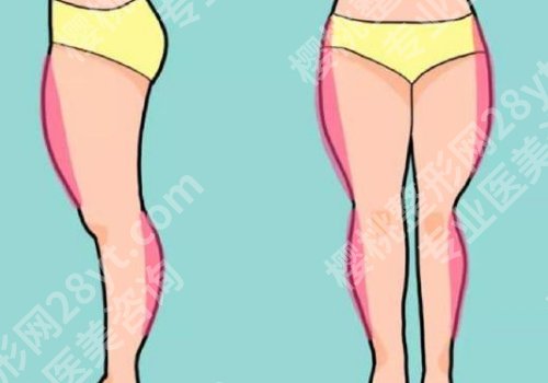北京协和医院腿部抽脂好的医生有谁？王阳、黄渭清、赵茹等技术稳定！