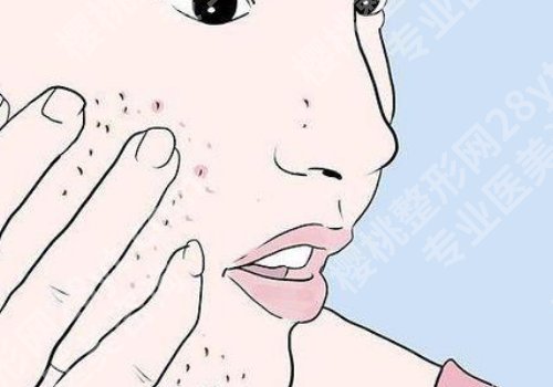 西安西京医院点阵激光价格需要多少？6000元起！医院简介及医院优势公开