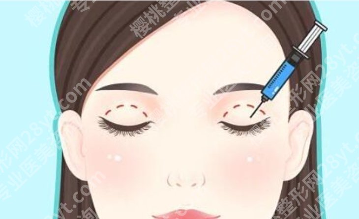 上海九院割双眼皮需要多少钱一次？单次费用、可能加项和预算一文算清