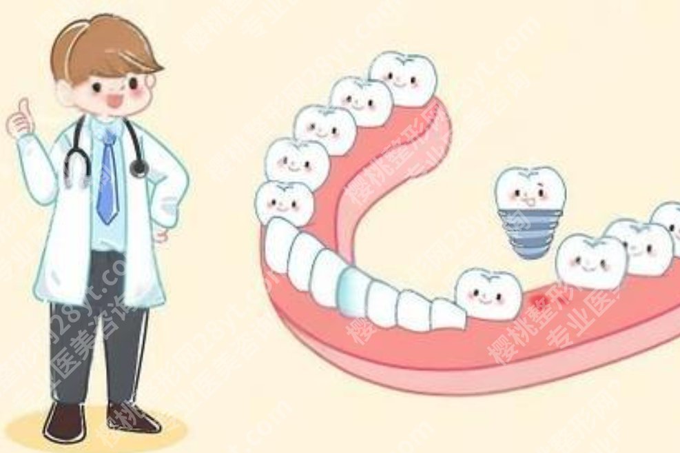 上海九院种牙多少钱一个？不同牙位、不同材料的价格区间参考