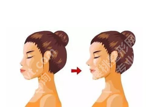 上海九院正颌手术做的怎么样?准确解决骨性难题、优势+价格双公开
