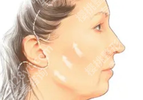 上海九院拉皮怎么样?抗衰王牌、放心体验不踩雷!网友点评、案例曝光