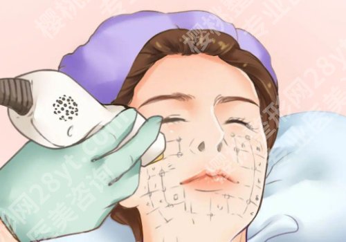 上海第九人民医院做热玛吉多少钱？5k起！案例多、口碑好！