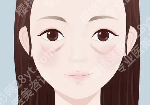 上海第九人民医院去眼袋的方法有哪些？覆盖内切、外切、激光等多种术式