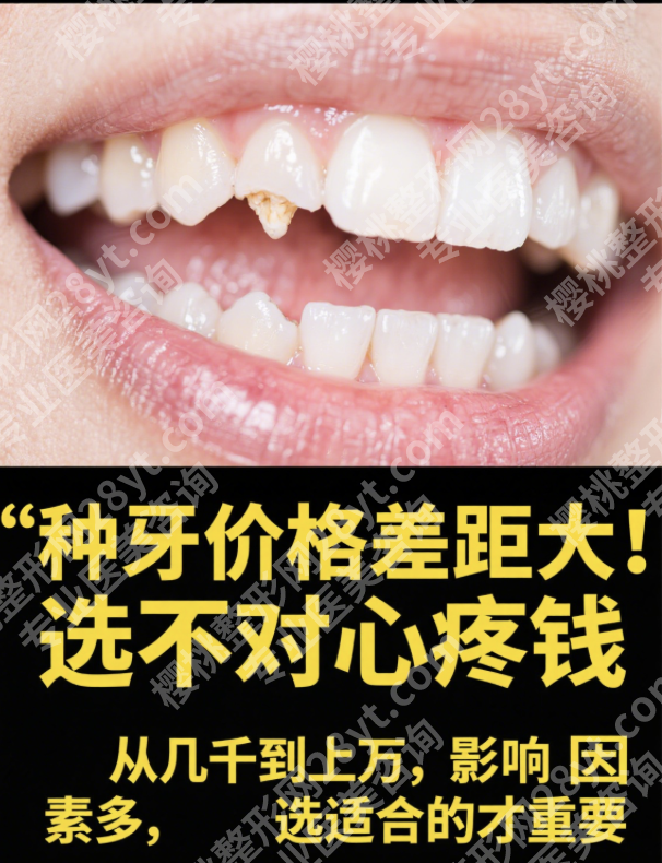 吉大医院种牙多少钱？怎么省钱？这些福利别错过