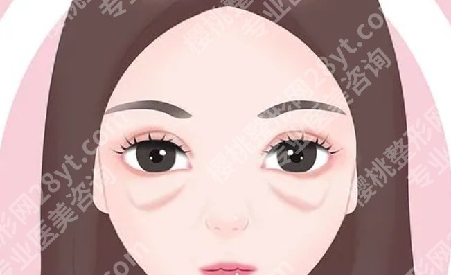 北京301医院祛眼袋需要多少钱？不同年龄、不同方案的价格段参考