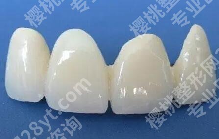 北医三院牙齿矫正费用是多少？价格详情揭秘，附医生、点评速看