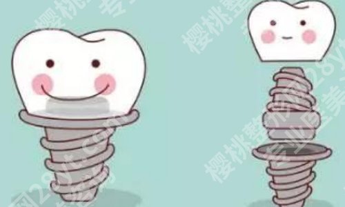 上海第九人民医院种植牙医生排名榜！赖红昌、吴轶群等值得推荐