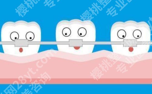 上海九院牙齿矫正医生推荐！房兵、张哲谌、杨一鸣等实力上榜