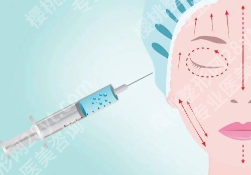 上海九院打玻尿酸挂什么科？整复外科医生注射精细！技术优势、口碑双曝光