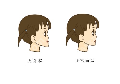 上海九院正颌手术费用多少钱?1万元起,人气医生与面诊建议分享!