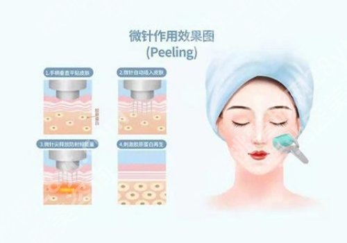 上海九院黄金微针在哪个科室？直接挂整复外科、项目优势、顾客点评大曝光
