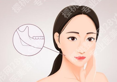 上海九院正颌科好的专家有谁？沈国芳、朱敏、张诗雷技术精湛、风格各有千秋