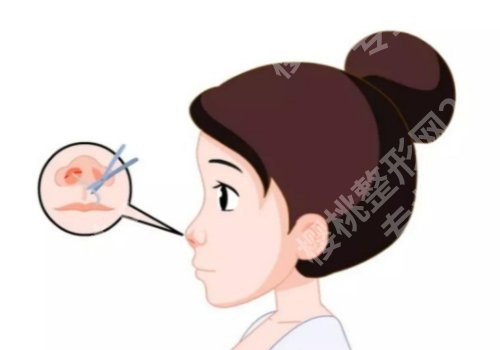 上海九院隆鼻好的医生有哪些？魏皎、王琛、周双白口碑好，技术全