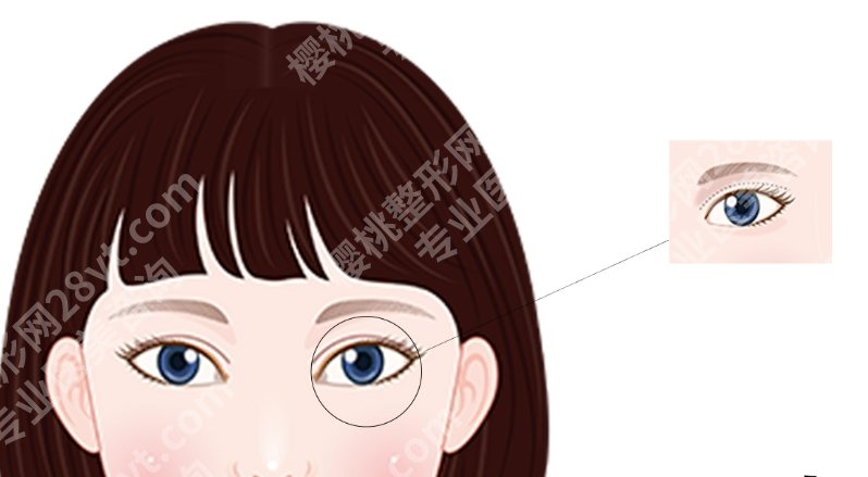 华西去眼袋挂什么科？挂科、咨询流程、术前沟通重点一次理清