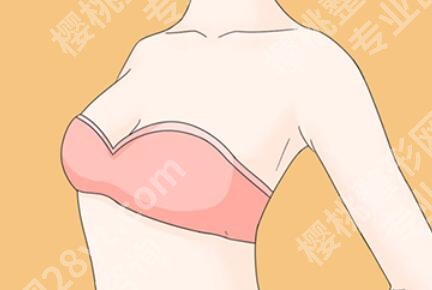 深圳北大医院脂肪填充费用是多少？脂肪填充价格为10389元起