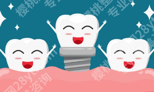 西京医院种牙多少钱一颗？低至于1w起、技术实力强