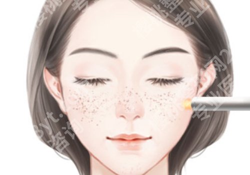 上海第九人民医院祛斑价格大概多少?低至2000元起!