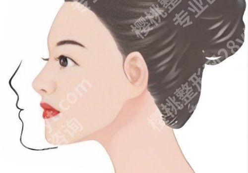 西安西京医院正颌手术医院排名怎么样？技术、优势名列前茅、口碑实至名归。