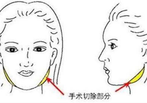 西京医院磨骨怎么样？附医院优势+顾客反馈，就诊必看！