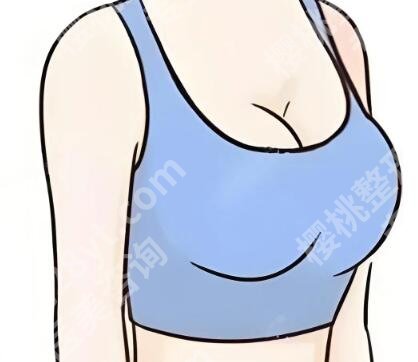 浙一隆胸价格是多少？隆胸价格为11771元起