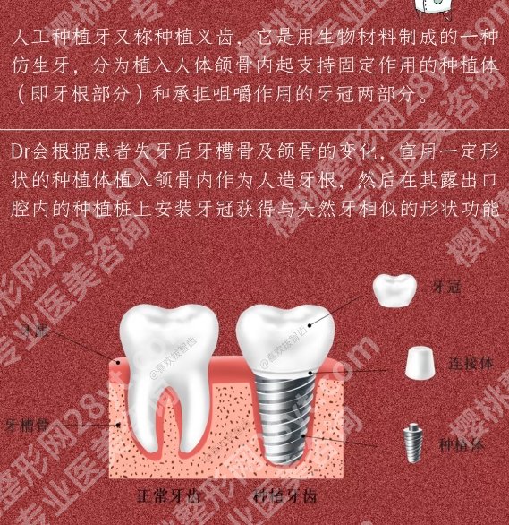浙一牙科专家一览表！刘丽华、林军、王慧明医生技术都超棒！