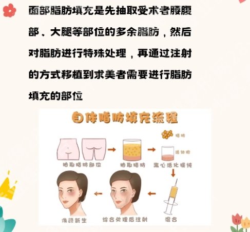 脂肪填充北京哪个医院好?医院基本信息及医生相关介绍!