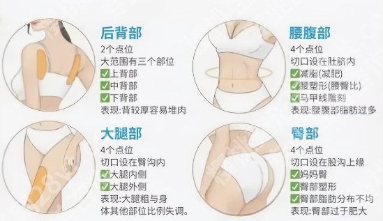 安徽省立医院抽脂价格单更新一览！附术前面诊小技巧！
