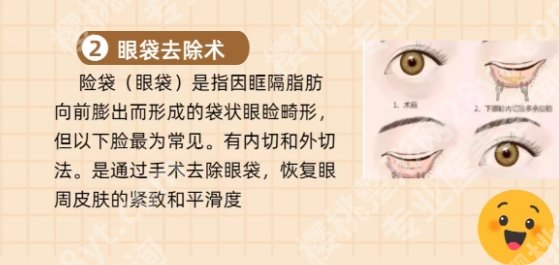 浙一医院去眼袋哪位医生好?医生团队资源相关介绍!收藏再看