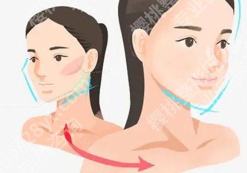 北京协和医院正颌手术多少钱？5万元左右起步、真实价格+干货分享！