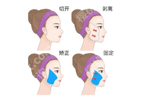 上海九院哪位医生拉皮手术好？金云波、李青峰、丁伟，好评率高！