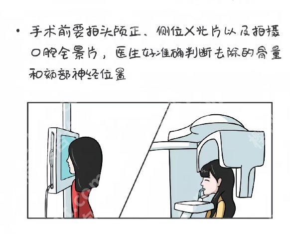 深圳北大医院磨骨怎么样?精准轮廓重塑的选择!