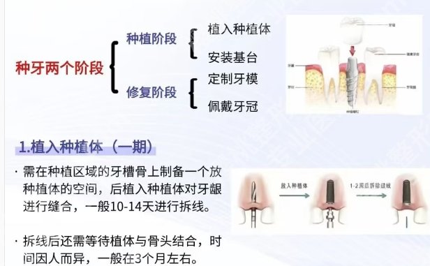 山东省立医院口腔科哪个医生好?吴海威、赵文、吴益华均上榜!