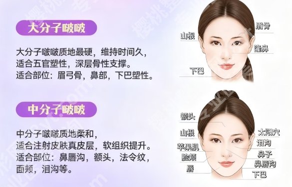 南方医院打玻尿酸哪个医生好?用户口碑来袭!速速来看