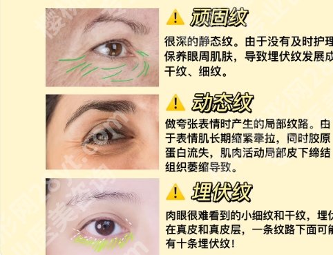 安徽省立医院除皱怎么样?医院资质及真实口碑点评!