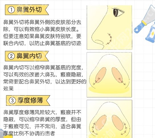 八大处整形收费标准!变美常见问题一站式掌握！