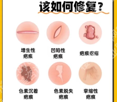 吉大一院整形科去除疤痕怎么样？资质、案例一站式参考