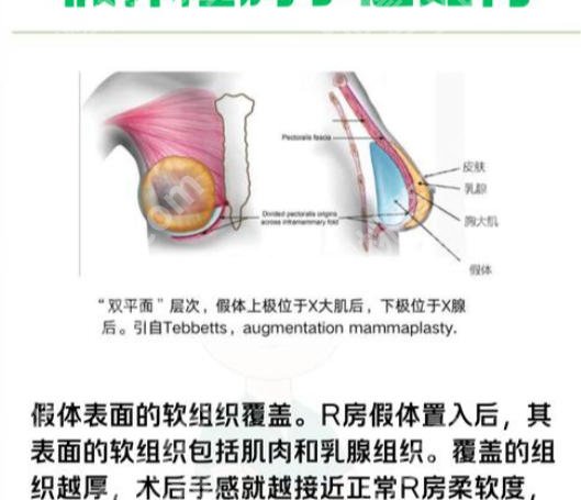 深圳北大医院假体隆胸怎么样？医院信息、热门项目推荐！