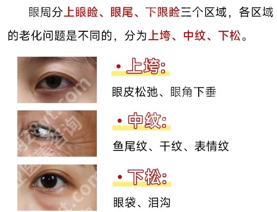 深圳北大医院整形外科擅长眼周整形吗？医院口碑点评来袭!