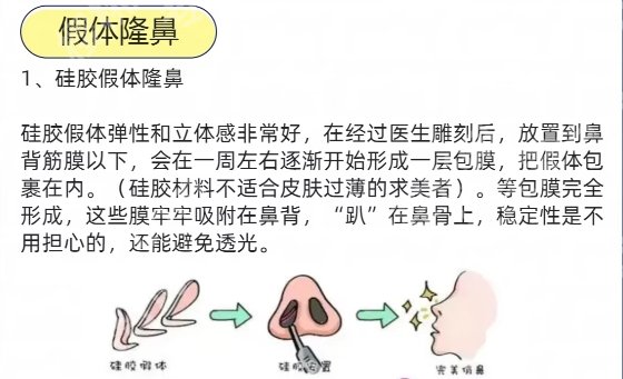 北京301医院做鼻子怎么样？从案例到口碑全解析！