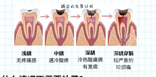 北京301医院牙科怎么样？医院明星项目详细介绍！戳进来看